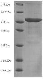 acinetobacter elisa kit|Acinetobacter .